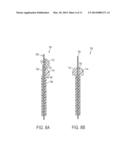 LOW PROFILE REAMERS AND METHODS OF USE diagram and image