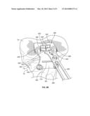 Patient-Specific Orthopedic Instruments diagram and image