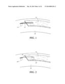 SYSTEM AND METHOD FOR ATTACHING SOFT TISSUE TO BONE diagram and image