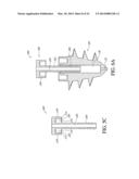 SYSTEM AND METHOD FOR ATTACHING SOFT TISSUE TO BONE diagram and image