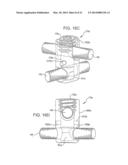 Crossbar Spinal Prosthesis Having A Modular Design and Related     ImplantationMethods diagram and image