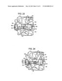 Crossbar Spinal Prosthesis Having A Modular Design and Related     ImplantationMethods diagram and image