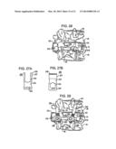 Crossbar Spinal Prosthesis Having A Modular Design and Related     ImplantationMethods diagram and image