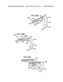 Crossbar Spinal Prosthesis Having A Modular Design and Related     ImplantationMethods diagram and image