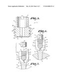 ANTI-SPLAY MEDICAL IMPLANT CLOSURE WITH MULTI-SURFACE REMOVAL APERTURE diagram and image