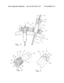 FASTENING SYSTEM FOR INTERNAL FIXATION diagram and image