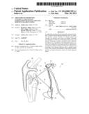 ADJUSTABLE SUTURE-BUTTON CONSTRUCT FOR KNOTLESS STABILIZATION OF CRANIAL     CRUCIATE DEFICIENT LIGAMENT STIFLE diagram and image