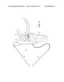 ADJUSTABLE SUTURE-BUTTON CONSTRUCT FOR KNOTLESS STABILIZATION OF CRANIAL     CRUCIATE DEFICIENT LIGAMENT STIFLE diagram and image