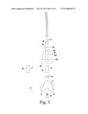 KNEE PROSTHESIS SYSTEM WITH STANDARD AND DISTAL OFFSET JOINT LINE diagram and image