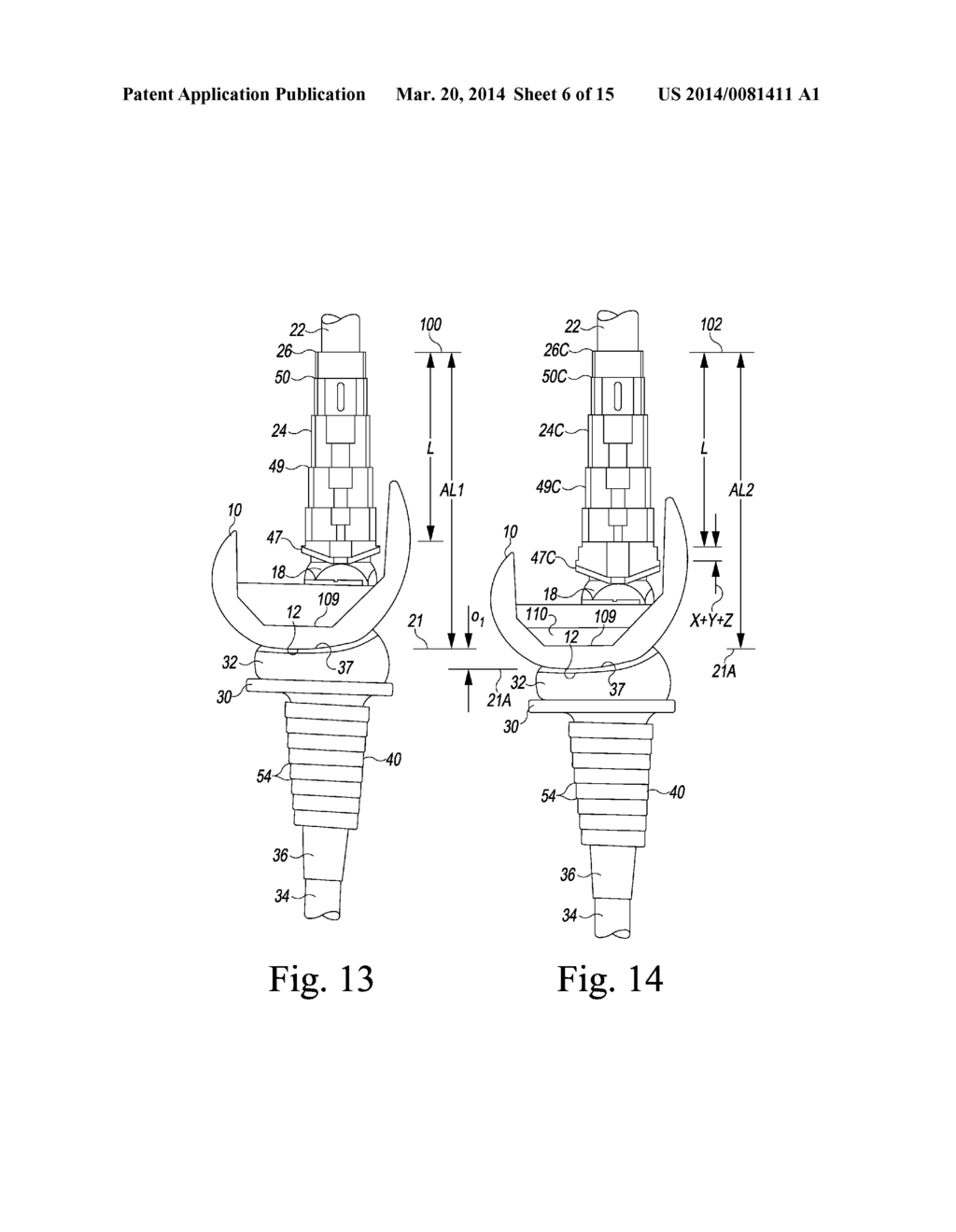 SURGICAL INSTRUMENT SYSTEM WITH MULTIPLE LENGTHS OF BROACHES SHARING A     COMMON GEOMETRY - diagram, schematic, and image 07