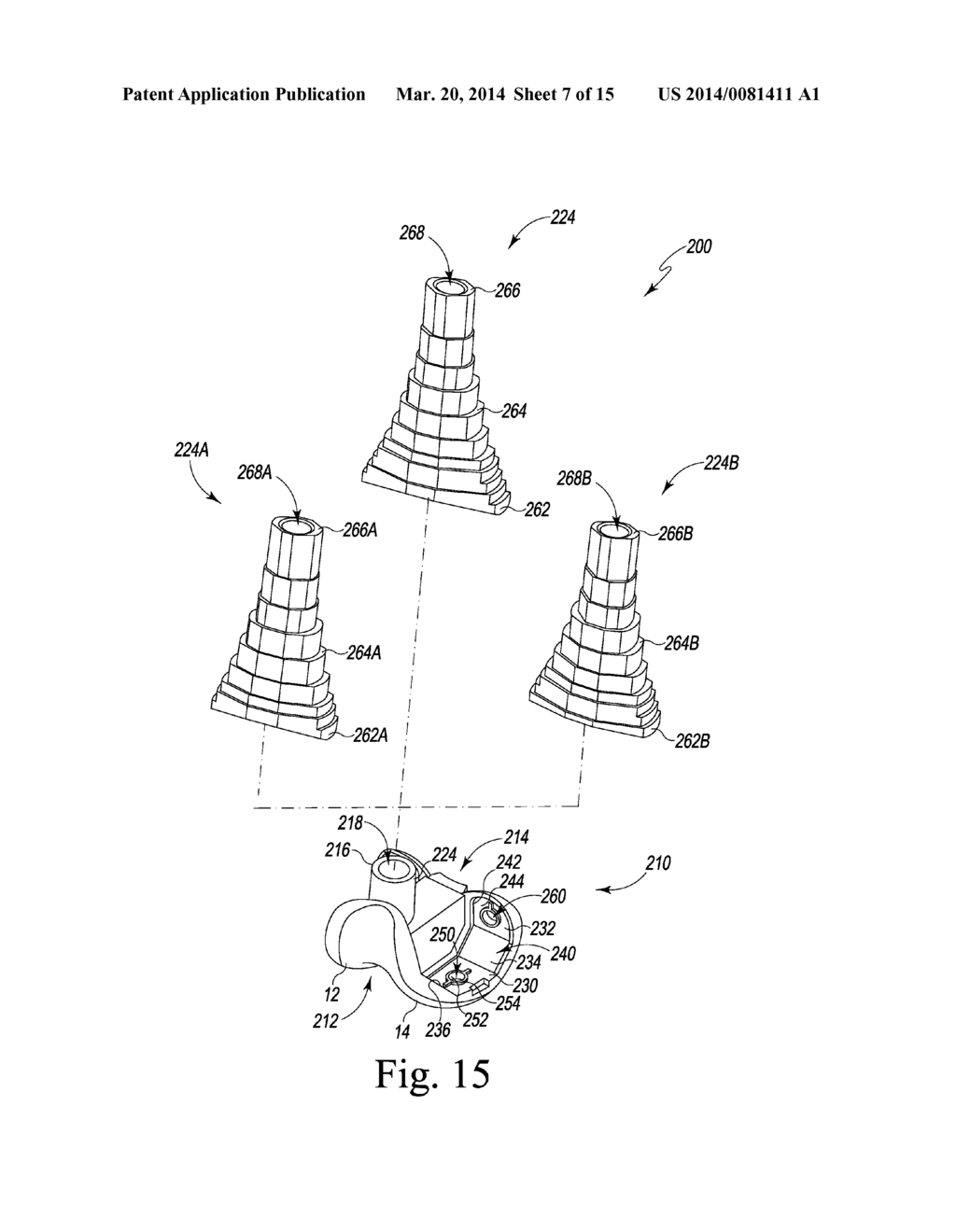 SURGICAL INSTRUMENT SYSTEM WITH MULTIPLE LENGTHS OF BROACHES SHARING A     COMMON GEOMETRY - diagram, schematic, and image 08