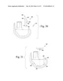 SURGICAL INSTRUMENT SYSTEM WITH MULTIPLE LENGTHS OF BROACHES SHARING A     COMMON GEOMETRY diagram and image