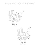 SURGICAL INSTRUMENT SYSTEM WITH MULTIPLE LENGTHS OF BROACHES SHARING A     COMMON GEOMETRY diagram and image