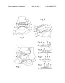 Ankle-Joint Endoprosthesis diagram and image