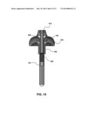 Transcutaneous Implant for Skeletal Attachment of External Prosthetic     Devices diagram and image