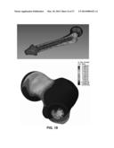 Transcutaneous Implant for Skeletal Attachment of External Prosthetic     Devices diagram and image