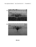 Transcutaneous Implant for Skeletal Attachment of External Prosthetic     Devices diagram and image