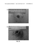 Transcutaneous Implant for Skeletal Attachment of External Prosthetic     Devices diagram and image