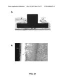 Transcutaneous Implant for Skeletal Attachment of External Prosthetic     Devices diagram and image