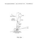 HYBRID TERRAIN-ADAPTIVE LOWER-EXTREMITY SYSTEMS diagram and image