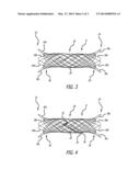 RADIOPAQUE SUPER-ELASTIC INTRAVASCULAR STENT diagram and image