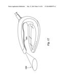 HAND IRONS diagram and image