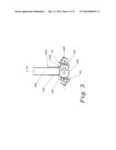 ANCHORING SYSTEM WITH POST ANGULAR ADJUSTMENT diagram and image