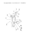 ANCHORING SYSTEM WITH POST ANGULAR ADJUSTMENT diagram and image