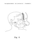 COMBINATION ANESTHESIA AND SCAVENGER SURGICAL MASK diagram and image