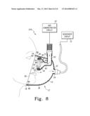 COMBINATION ANESTHESIA AND SCAVENGER SURGICAL MASK diagram and image