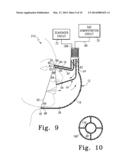 COMBINATION ANESTHESIA AND SCAVENGER SURGICAL MASK diagram and image