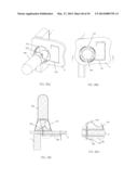 BRACKET AND SLEEVE ASSEMBLY diagram and image