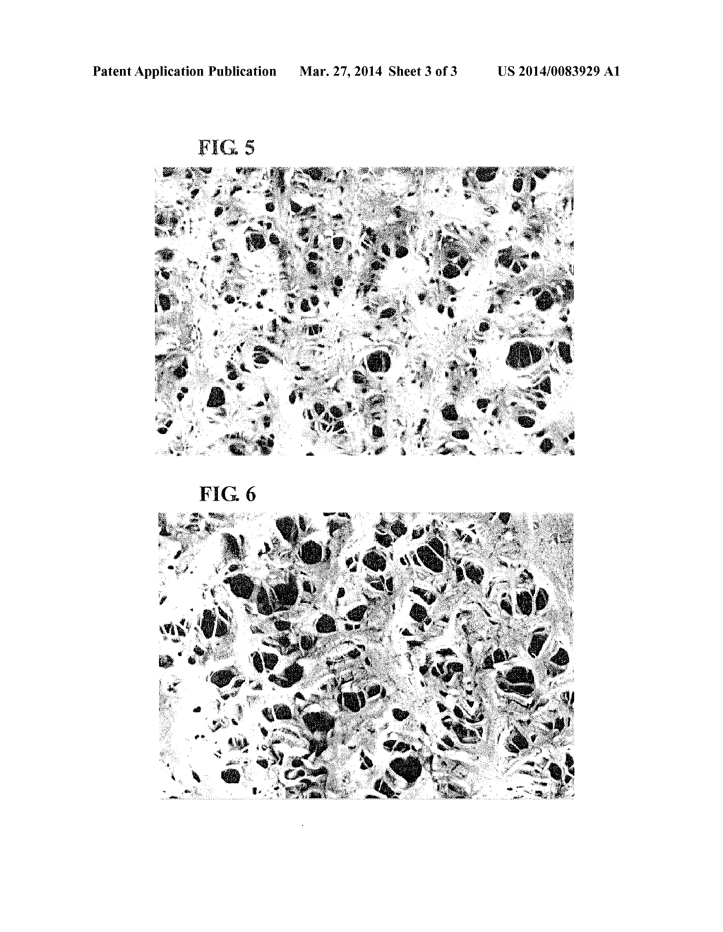 MICROPOROUS MODIFIED-POLYTETRAFLUOROETHYLENE MEMBRANE,     POROUS-MODIFIED-POLYTETRAFLUOROETHYLENE-MEMBRANE COMPOSITE AND PRODUCTION     PROCESS THEREOF, AND SEPARATION MEMBRANE ELEMENT - diagram, schematic, and image 04