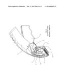 Skin Stapler with Components Protected for Clean Bin Recycling diagram and image