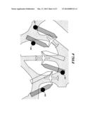 SYSTEMS AND METHODS FOR USING RADAR-ADAPTIVE BEAM PATTERN FOR WINGTIP     PROTECTION diagram and image