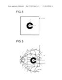 FUNDUS OBSERVATION APPARATUS diagram and image