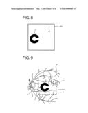 FUNDUS OBSERVATION APPARATUS diagram and image