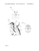 DYNAMIC LOCAL REGISTRATION SYSTEM AND METHOD diagram and image