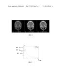 IMAGE RECONSTRUCTION USING GRADIENT PROJECTION FOR MEDICAL IMAGING     APPLICATIONS diagram and image