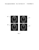 IMAGE RECONSTRUCTION USING GRADIENT PROJECTION FOR MEDICAL IMAGING     APPLICATIONS diagram and image