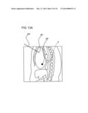 X-RAY CT APPARATUS diagram and image