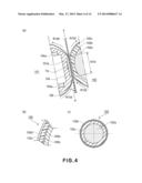 FIXING APPARATUS diagram and image