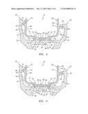 INTERSTAGE COVERPLATE ASSEMBLY FOR ARRANGING BETWEEN ADJACENT ROTOR STAGES     OF A ROTOR ASSEMBLY diagram and image