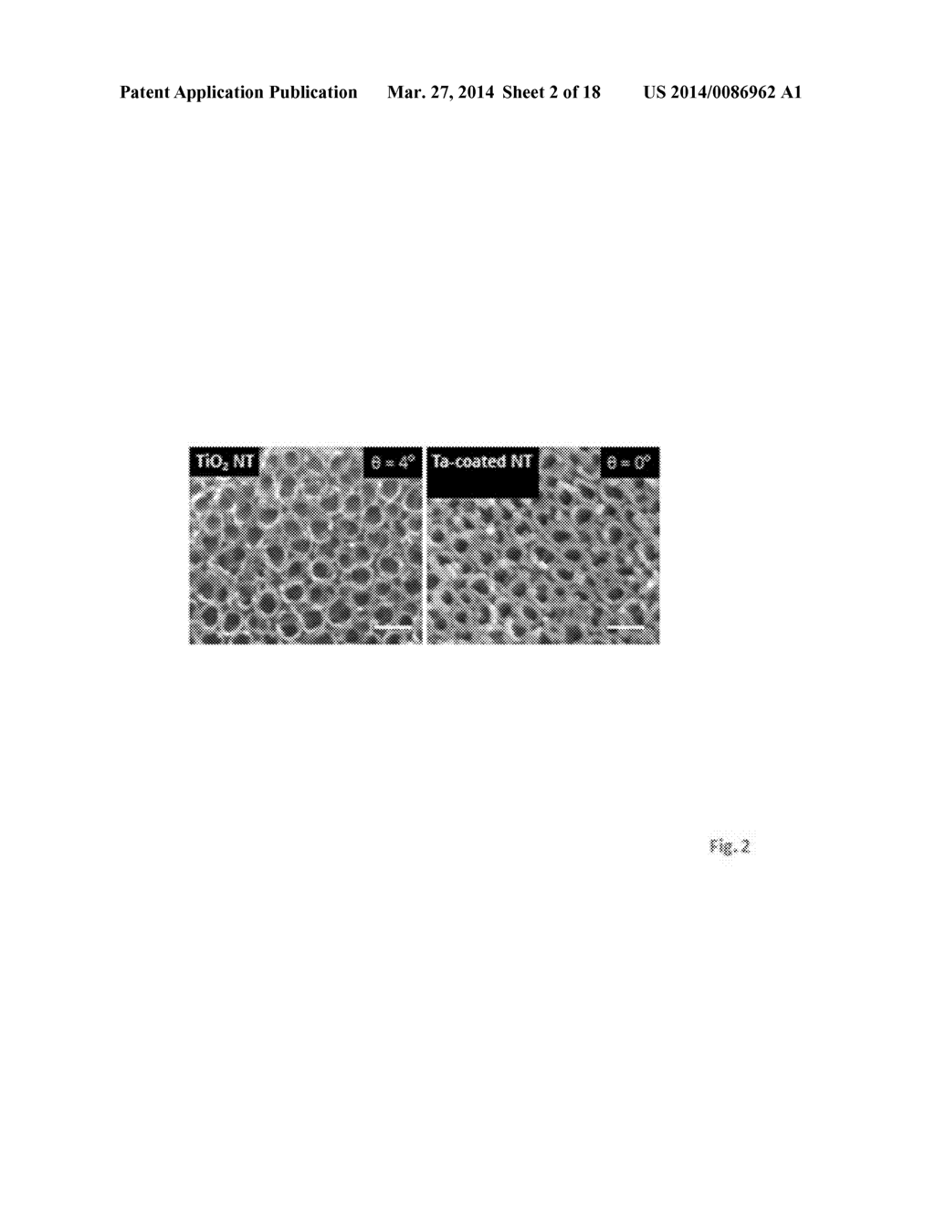 PRODUCTS OF MANUFACTURE HAVING TANTALUM COATED NANOSTRUCTURES, AND METHODS     OF MAKING AND USING THEM - diagram, schematic, and image 03