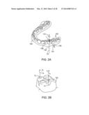 TOOTH MOVEMENT MEASUREMENT BY AUTOMATIC IMPRESSION MATCHING diagram and image