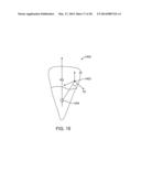 TOOTH MOVEMENT MEASUREMENT BY AUTOMATIC IMPRESSION MATCHING diagram and image