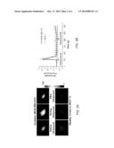 SYSTEM AND METHOD FOR DETERMINING TUMOR INVASIVENESS diagram and image