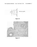 Compositions and Methods for Localized Drug Delivery through Mammary     Papillae diagram and image