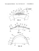 STABLE AORTIC BLOOD PUMP IMPLANT diagram and image