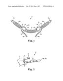 IMPLANTS, TOOLS, AND METHODS FOR TREATMENT OF PELVIC CONDITIONS diagram and image